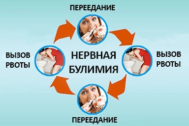 Лечение булимии в Цивильске